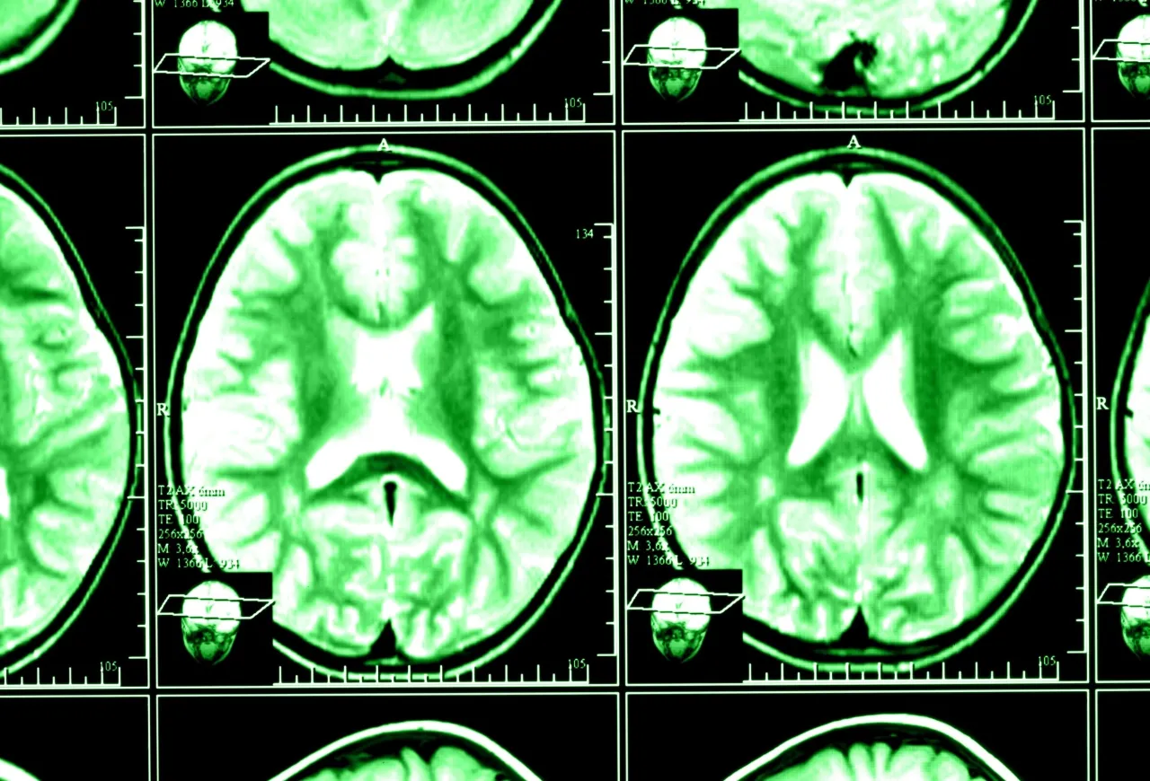 Obraz TK głowy z zaznaczonymi strukturami