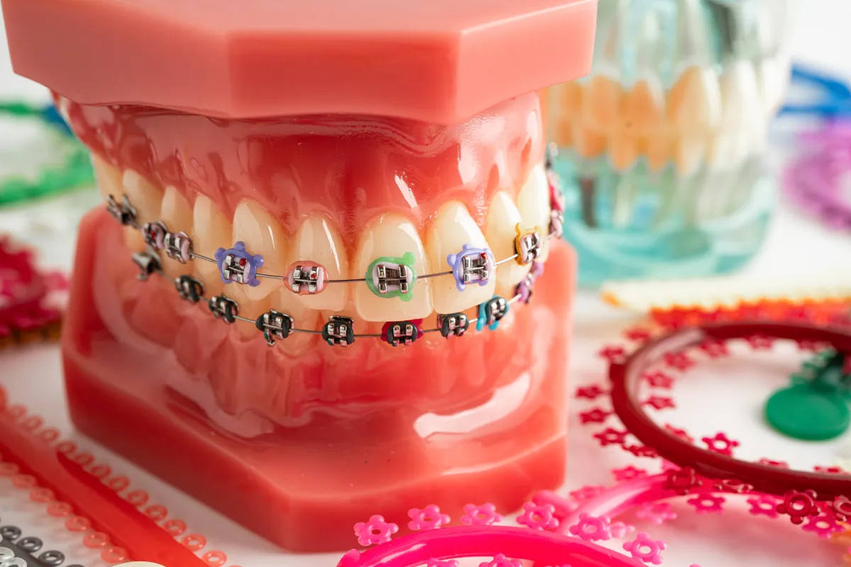 koszty leczenia ortodontycznego infografika