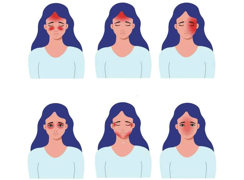 ból głowy przyczyny kręgosłup zatoki zęby