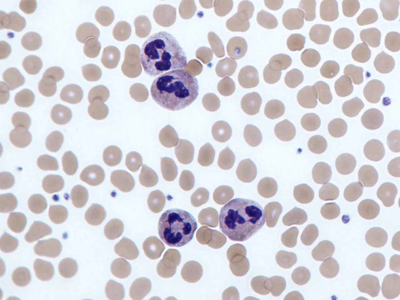 płytki krwi pod mikroskopem