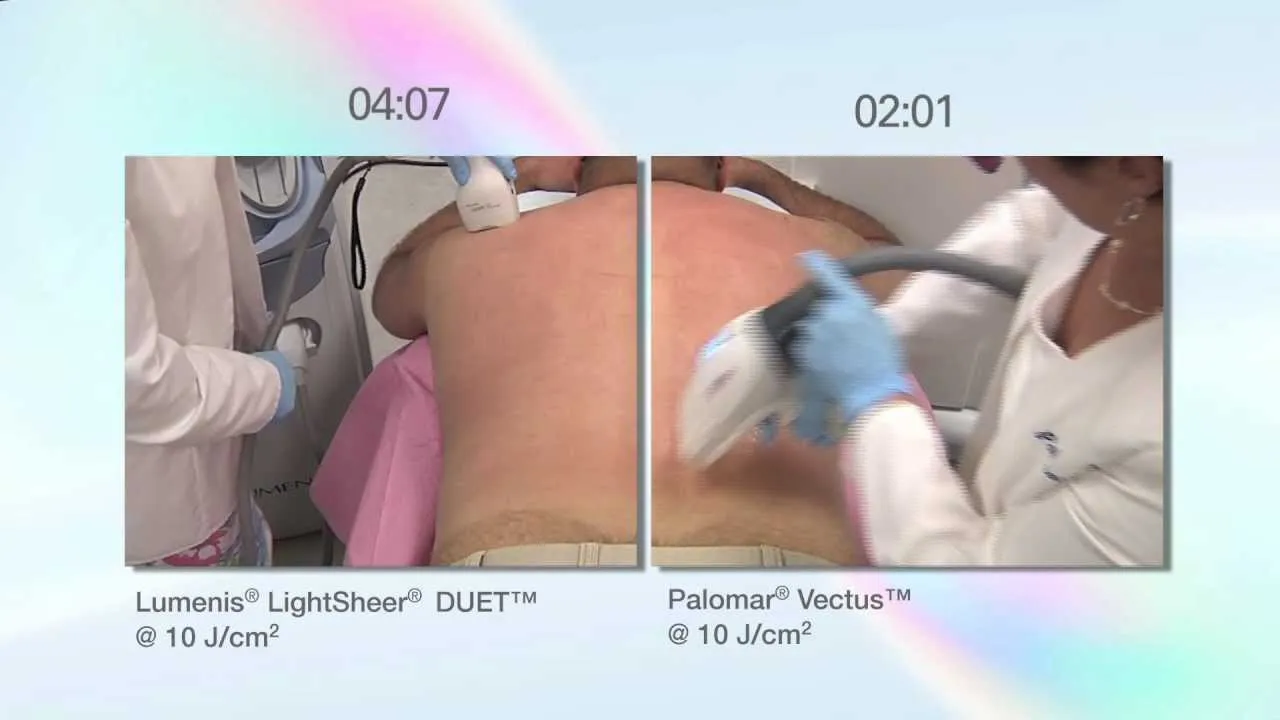 laser diodowy lightsheer vectus soprano ice