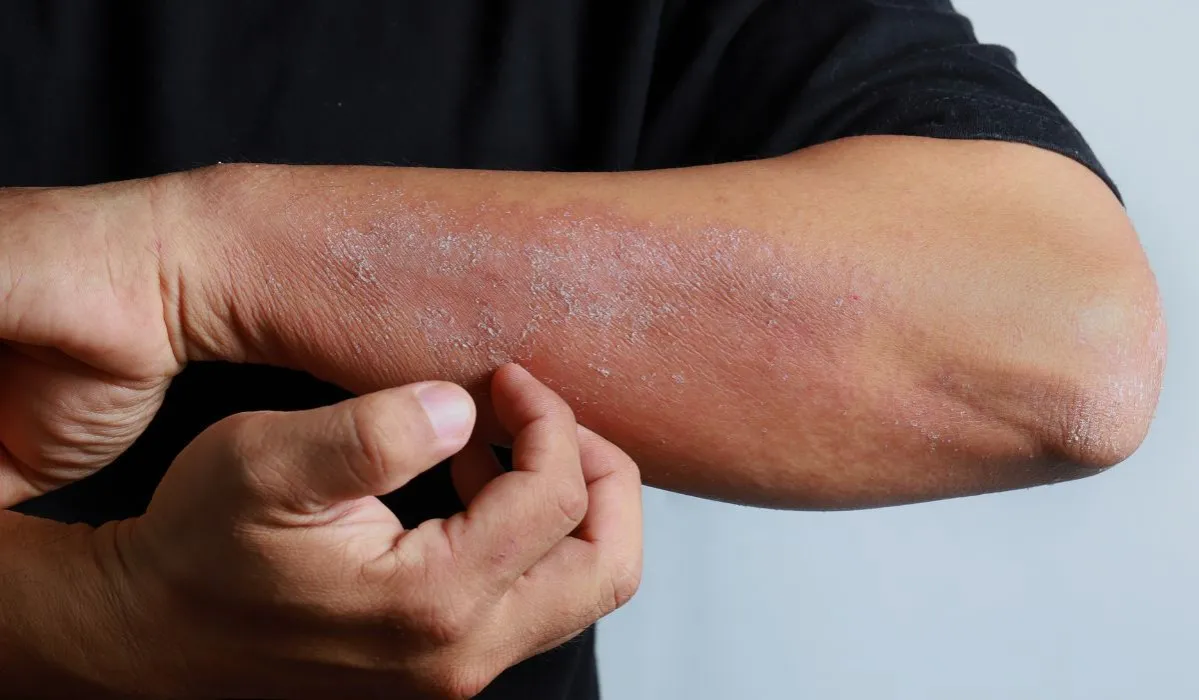 objawy sk&oacute;rne niedoboru potasu