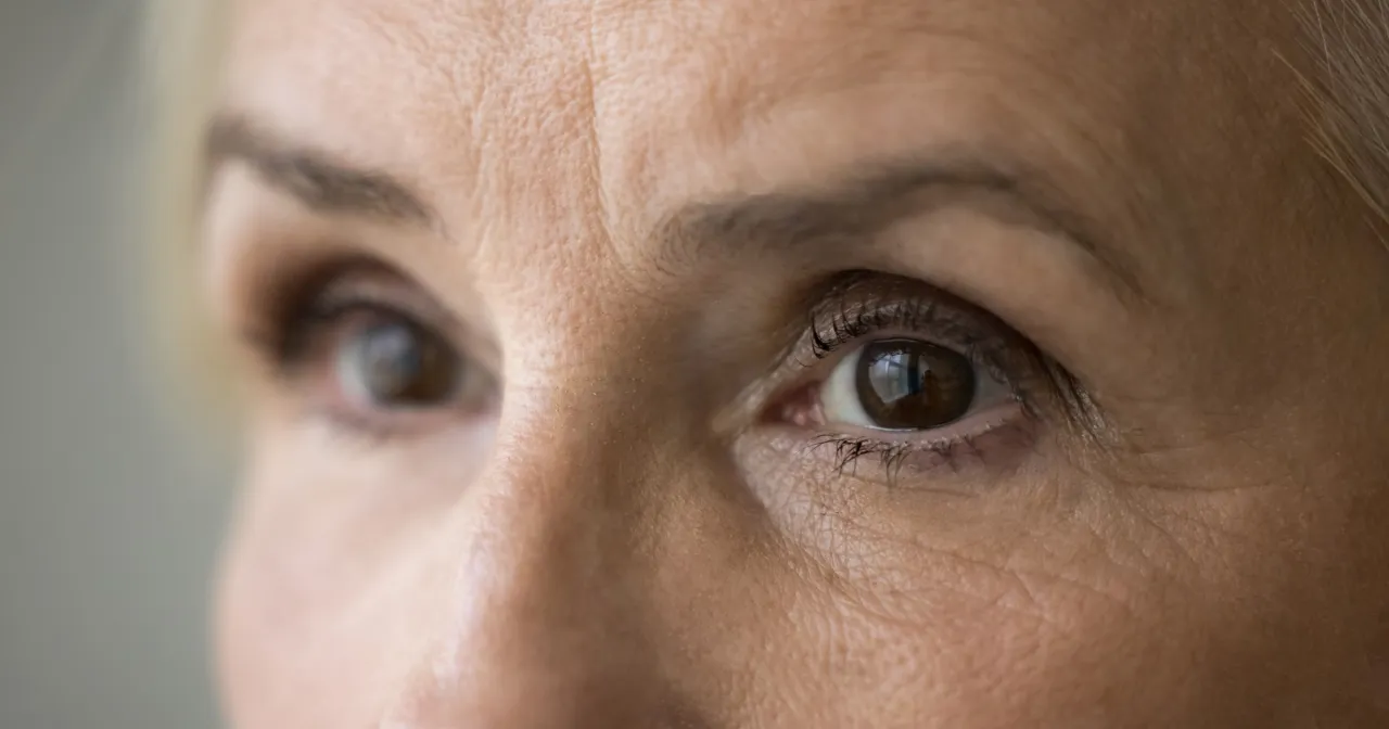 zmiany skórne wiek, zmarszczki, przebarwienia, utrata jędrności