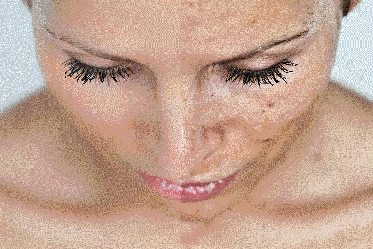 zabiegi na przebarwienia w gabinecie kosmetycznym