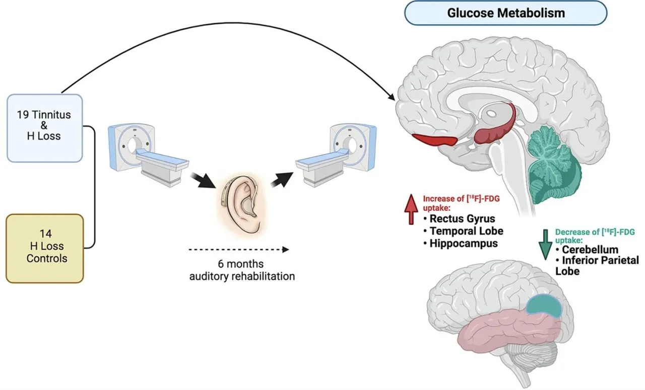 Diagnostyka szumów usznych