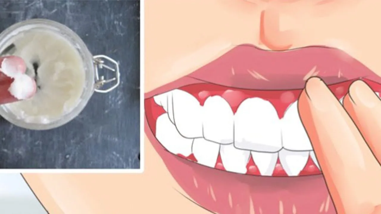 domowe sposoby na bolące dziąsła składniki