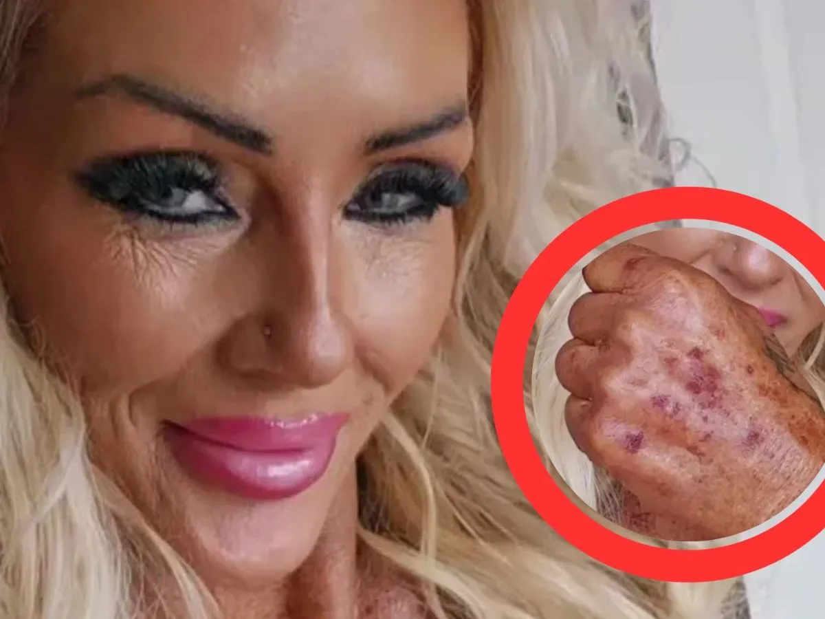 kobieta unika słońca, papierosów i alkoholu po zabiegu estetycznym