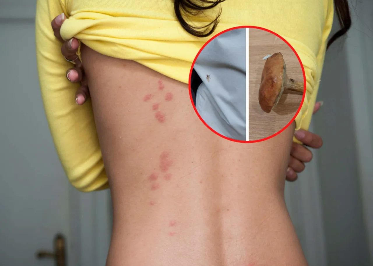 ukąszenie strzyżaka sarniego objawy