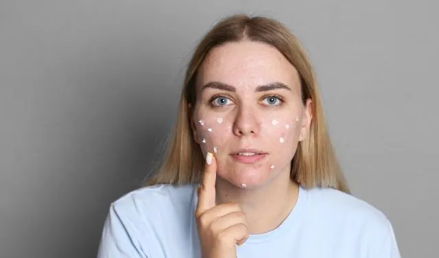 r&oacute;żnica zapchane pory a trądzik