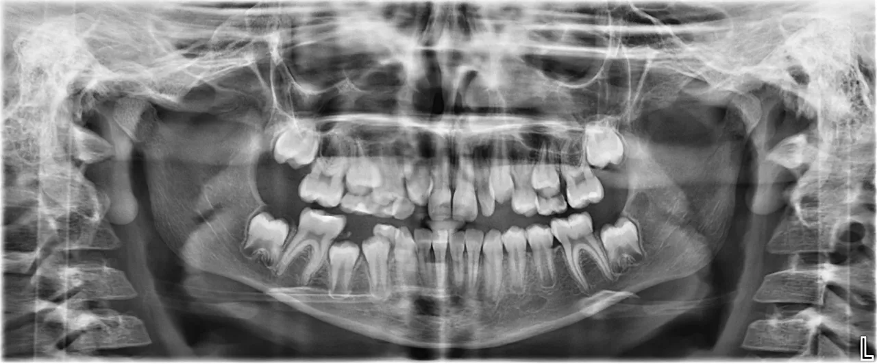 Pantomogram jamy ustnej