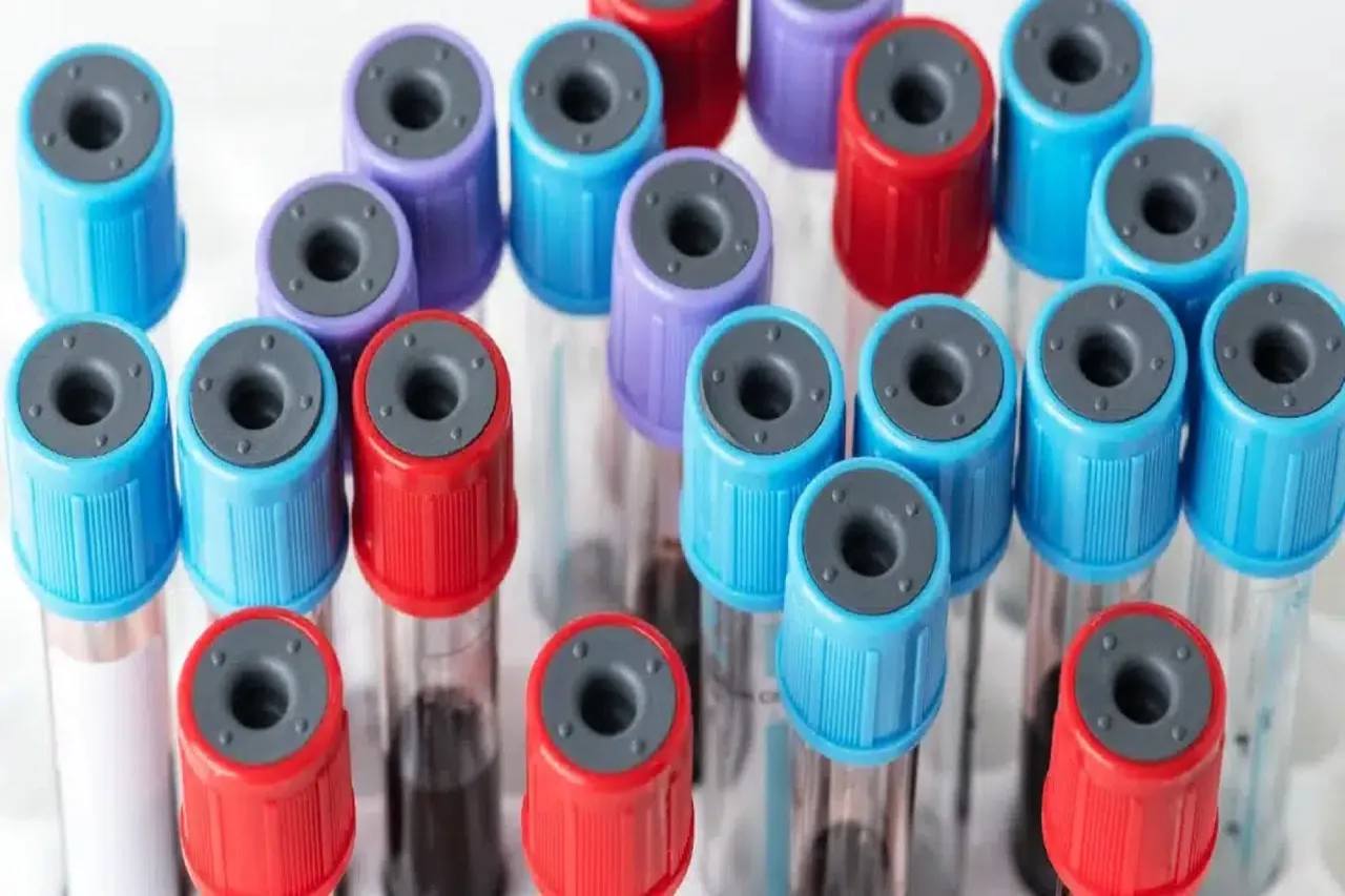 Probówki z krwią do badań laboratoryjnych
