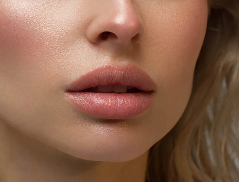 Usta po nieudanym powiększaniu kwasem hialuronowym