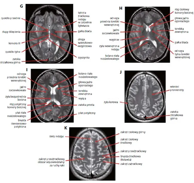 diagram ścieżka pacjenta rezonans magnetyczny