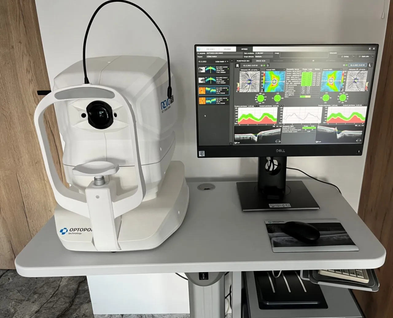 aparat oct badanie oka