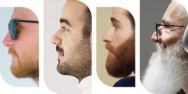 czynniki wpływające na wzrost zarostu