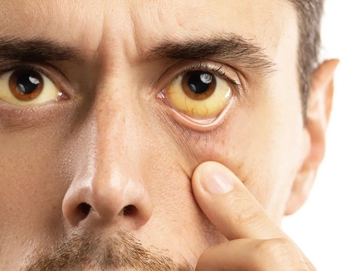 Zespół Gilberta objawy psychiczne infografika