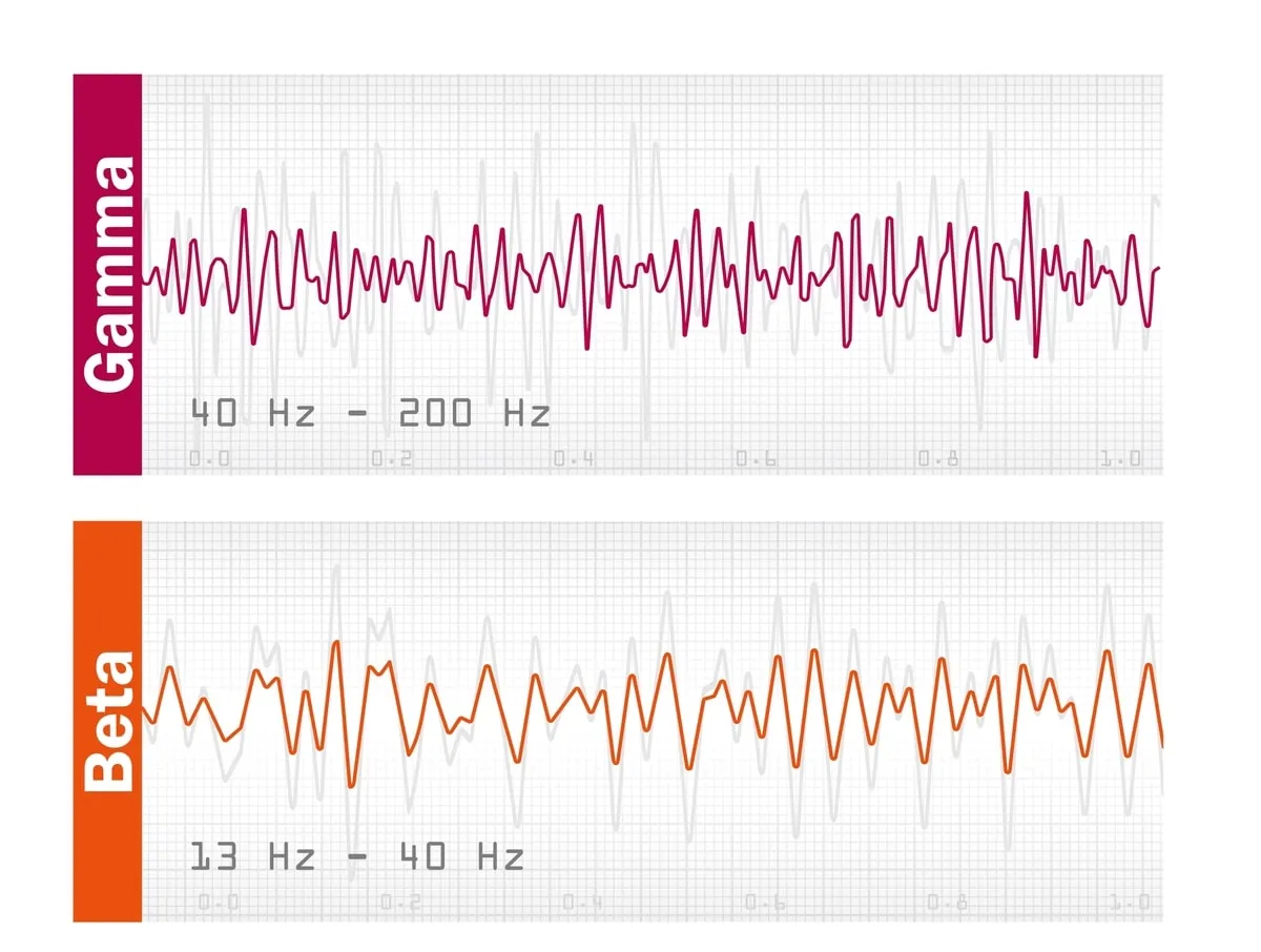 Rodzaje badania EEG por&oacute;wnanie