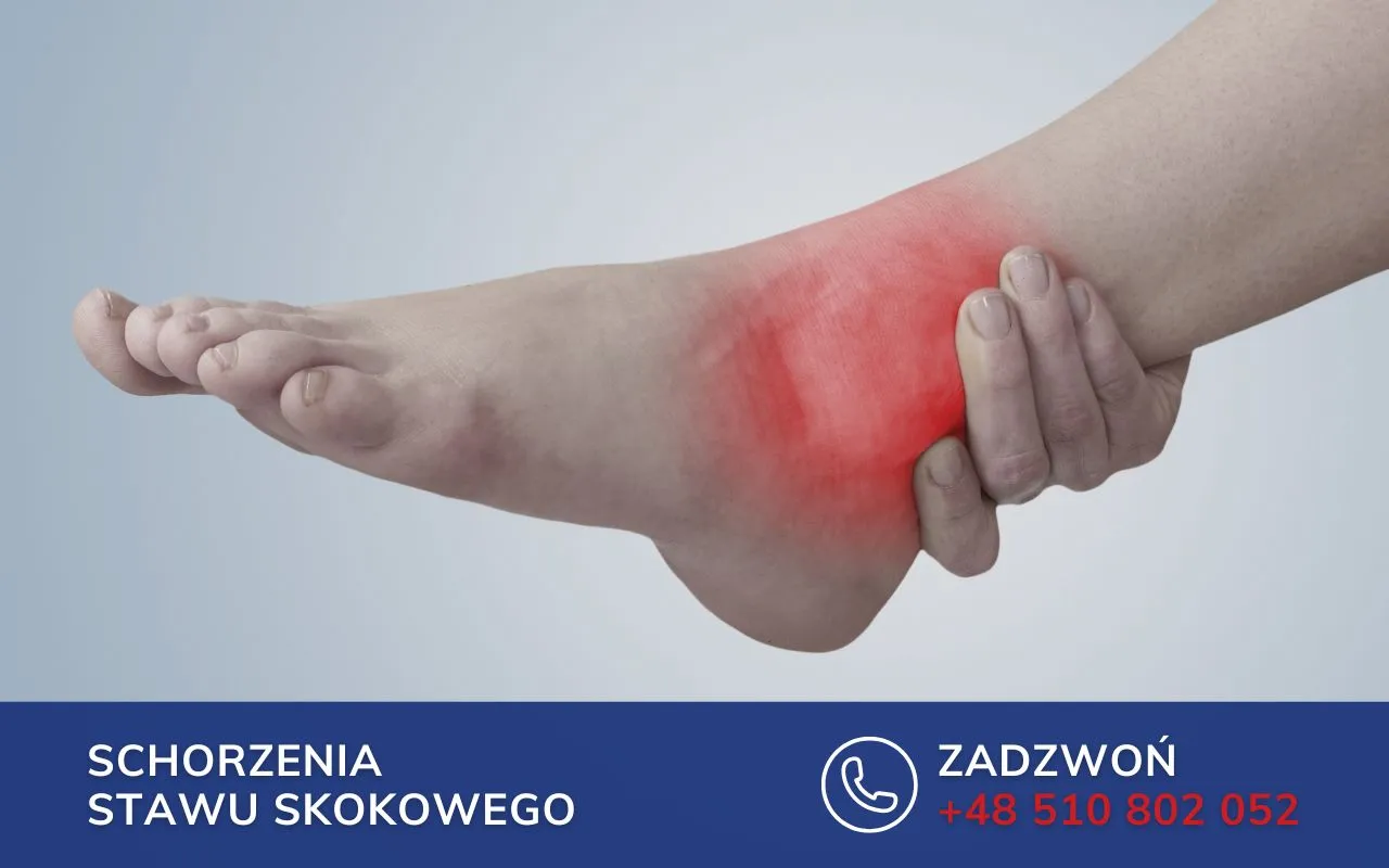 Ból i zaczerwienienie wokół kostki sugerują nieleczone złamanie kostki. Skontaktuj się z nami, aby uzyskać pomoc.