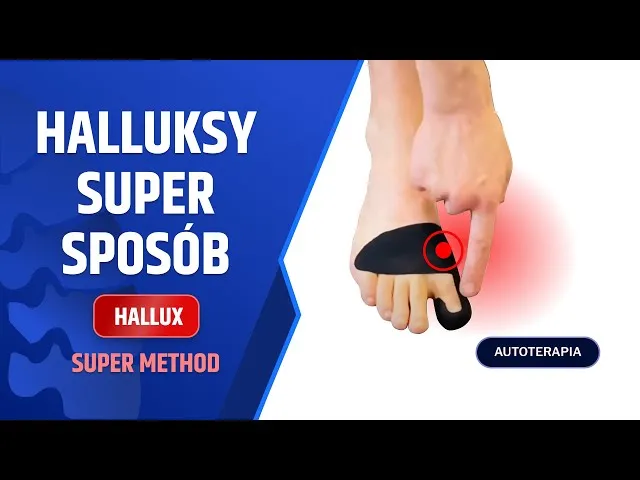 domowe sposoby na haluksy okłady masaż