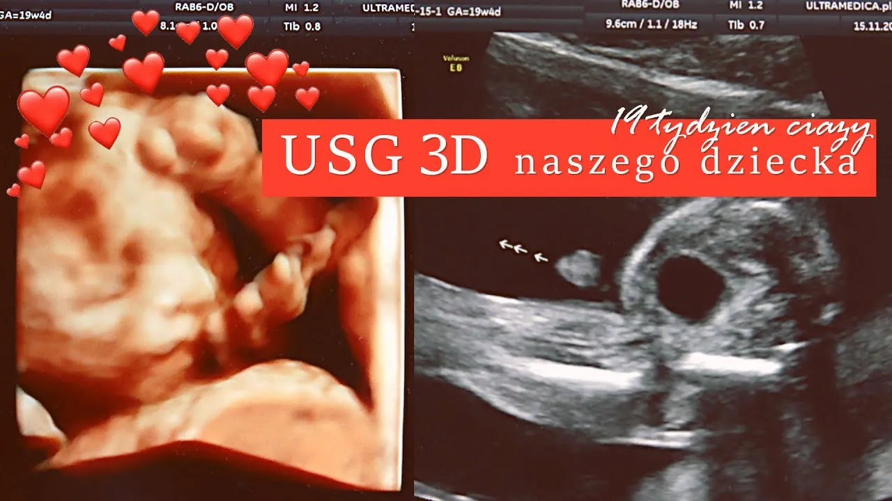 Zdjęcie Ile waży dziecko w 19 tyg ciąży? Waga, rozwój i USG połówkowe