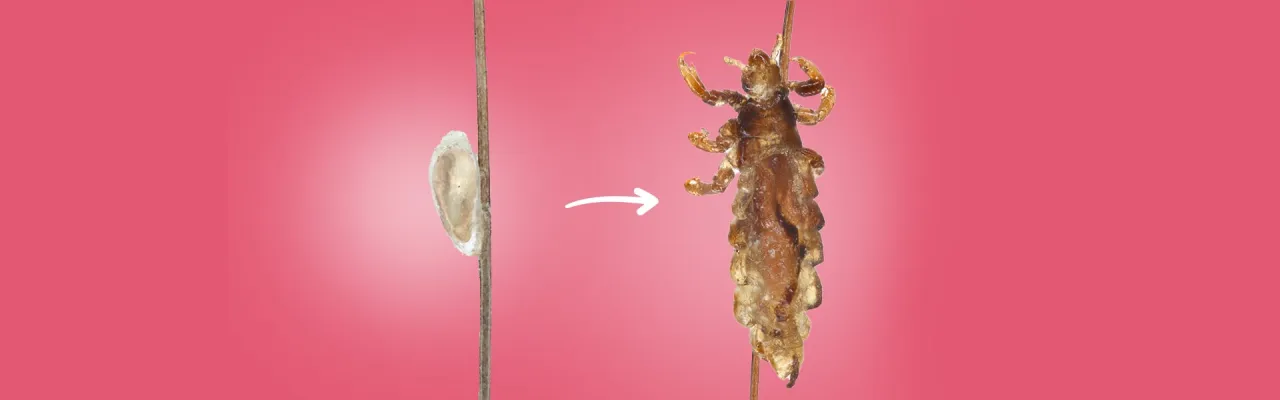 Zdjęcie Skąd się wzięła pierwsza wsza? Fascynująca historia ewolucji wszy