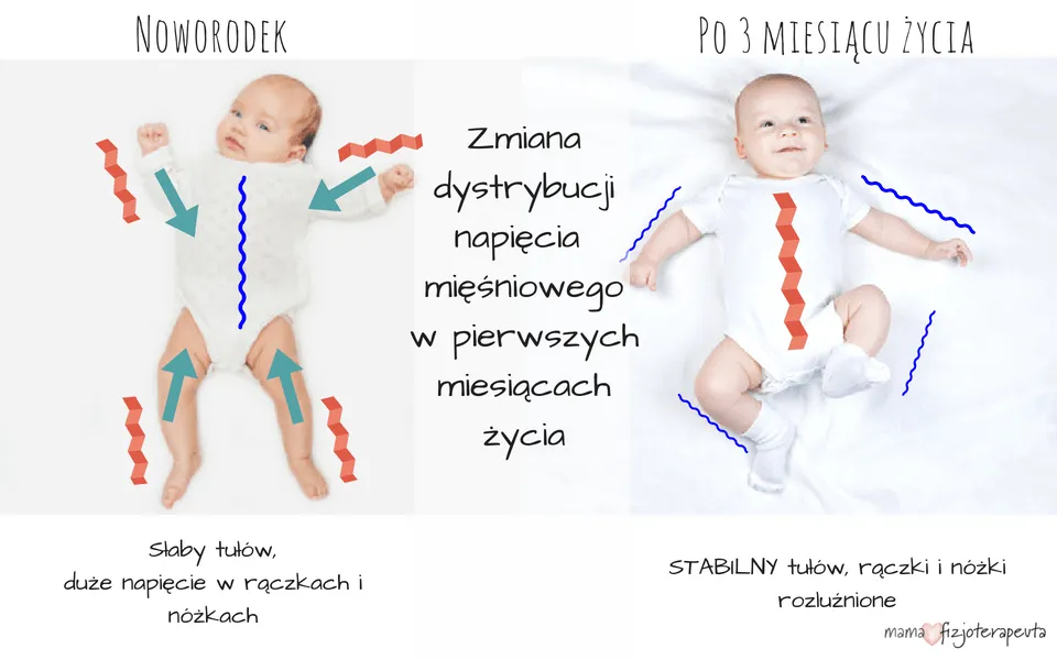 Zdjęcie Wzmożone napięcie mięśniowe u niemowlaka: niepokojące objawy, które musisz znać