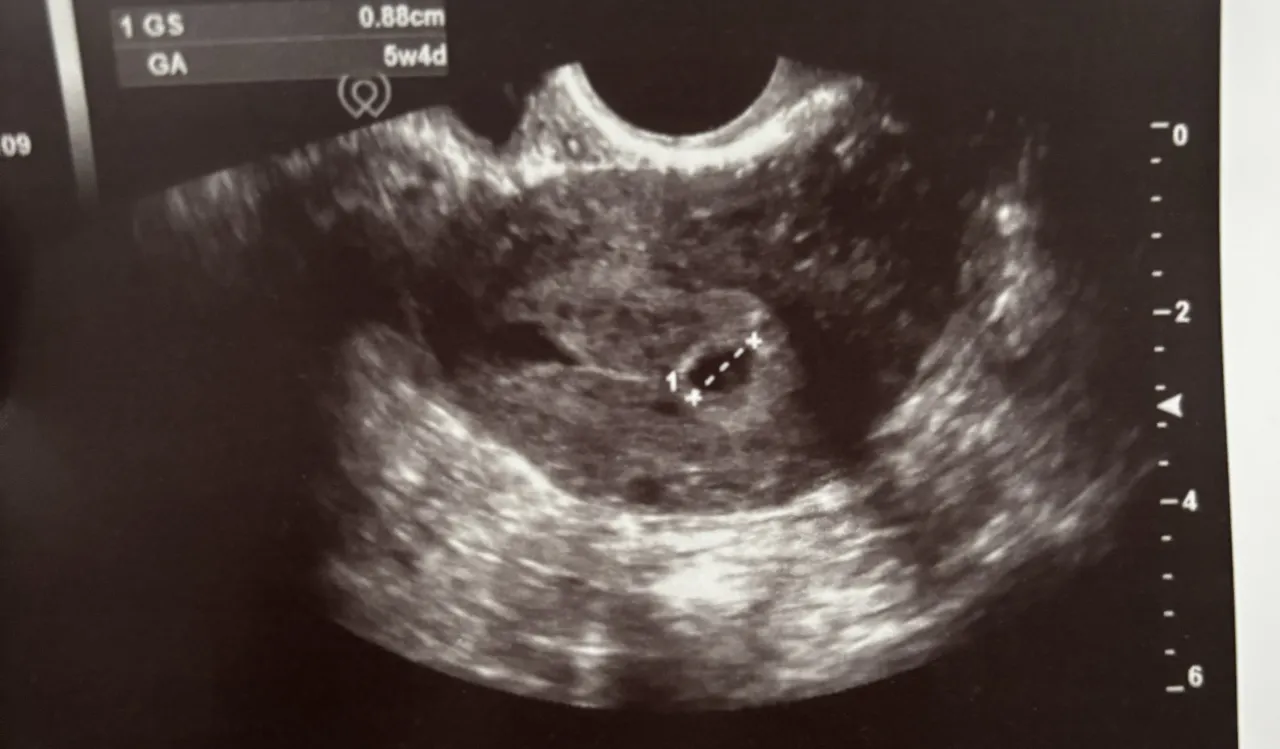 Dlaczego ciążę liczy się od ostatniej miesiączki