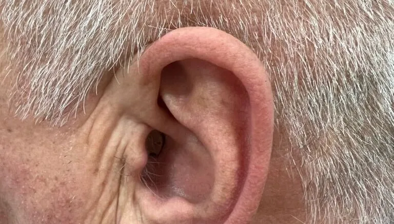 niewidoczne aparaty słuchowe porównanie modeli