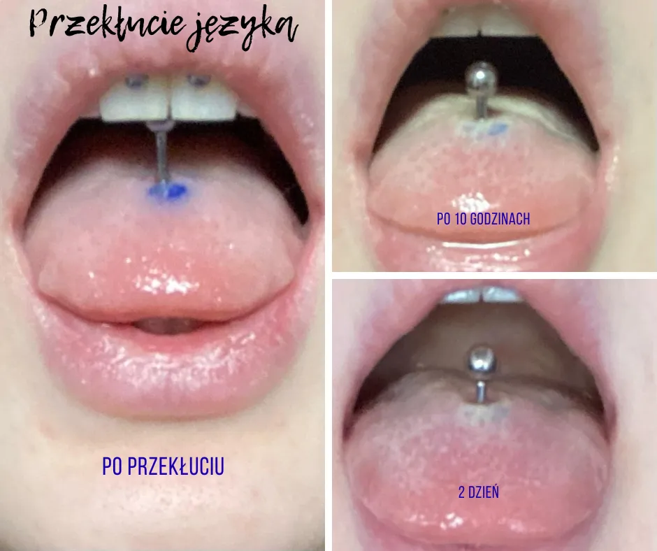 czego unikać przy gojeniu kolczyka