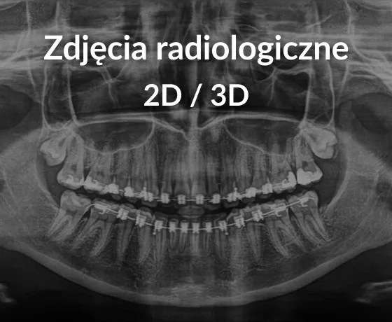 diagnostyka ortodontyczna zdjęcia rtg skan 3d