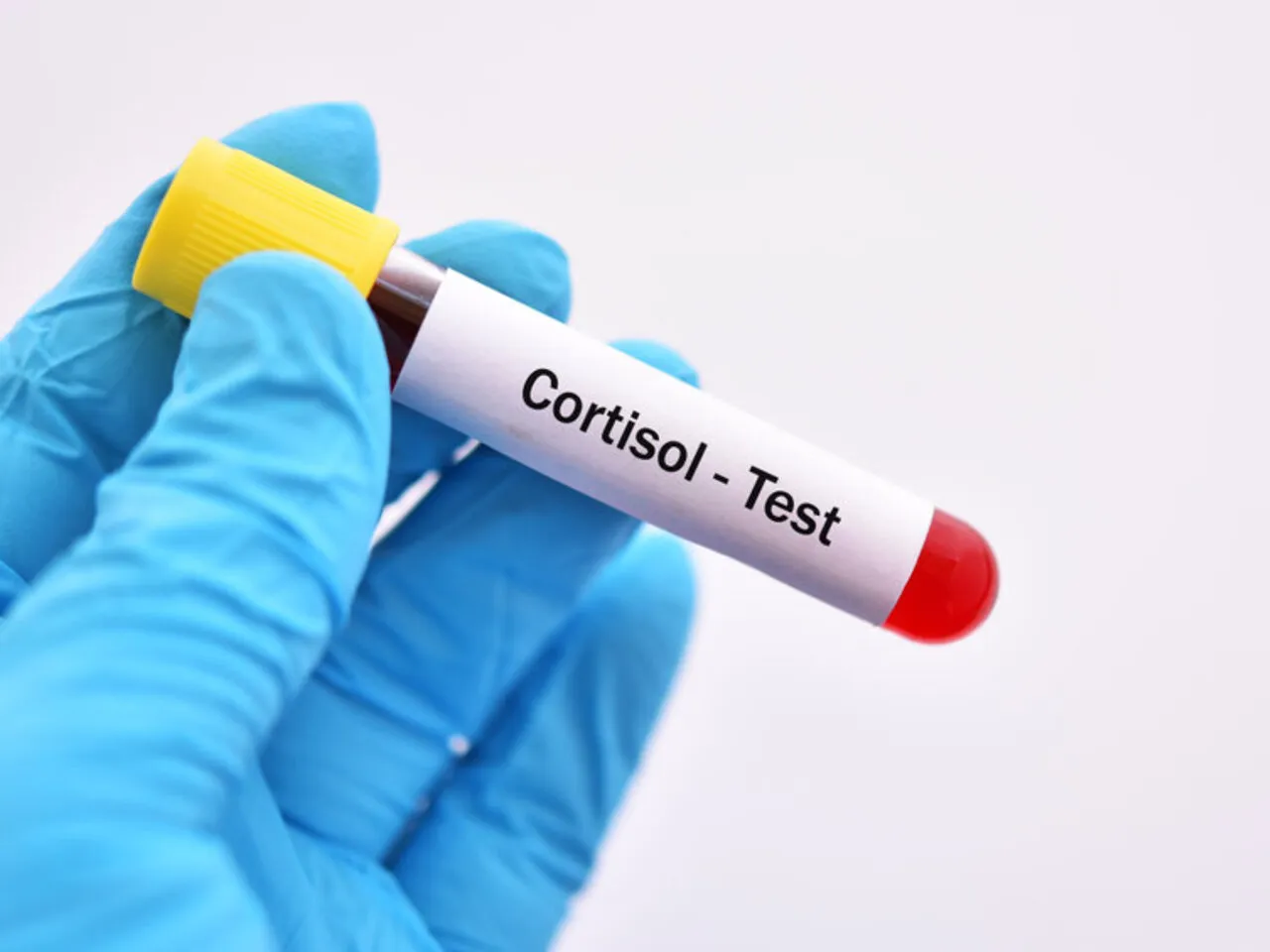 Suplementy na kortyzol badania naukowe
