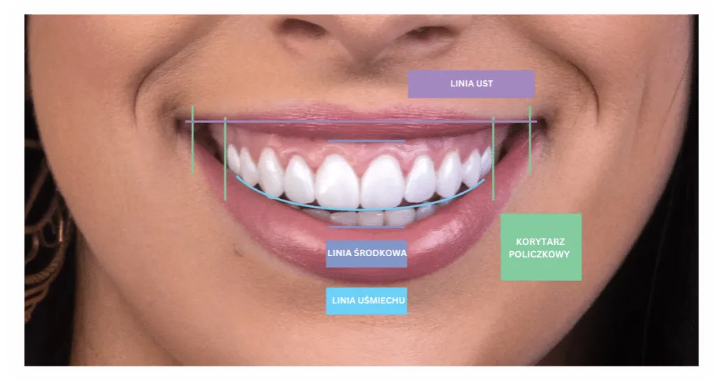 linia uśmiechu zęby estetyka