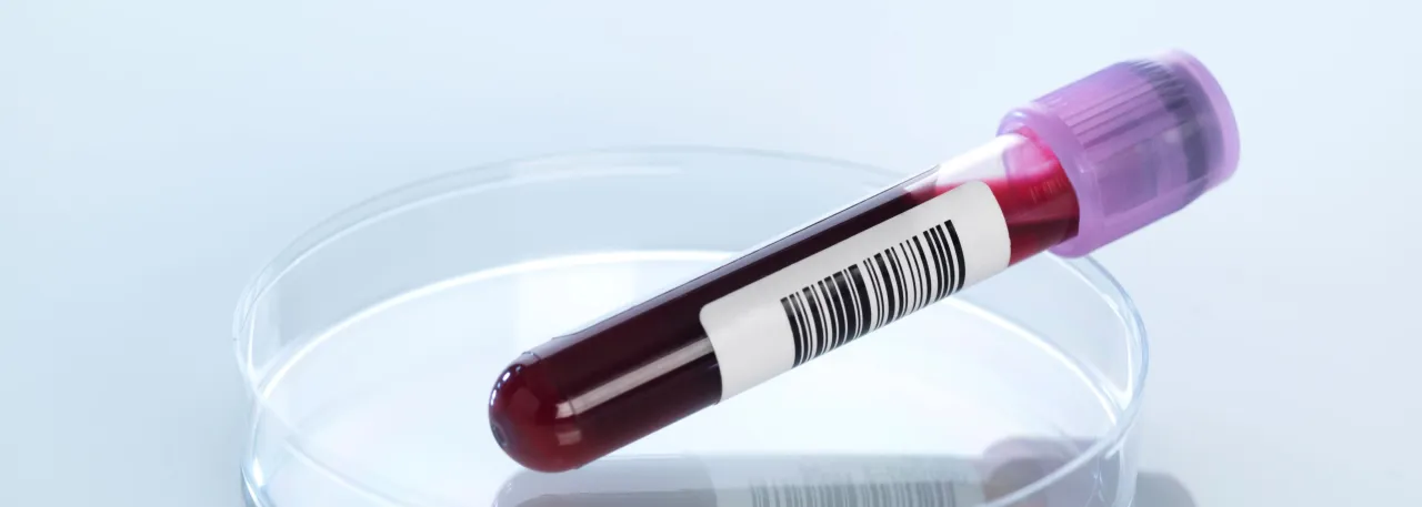 Mikroskopowe zdjęcie neutrofil&oacute;w ANCA