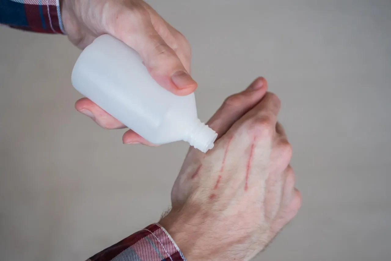 nowoczesne środki odkażające rany, porównanie woda utleniona a octenisept