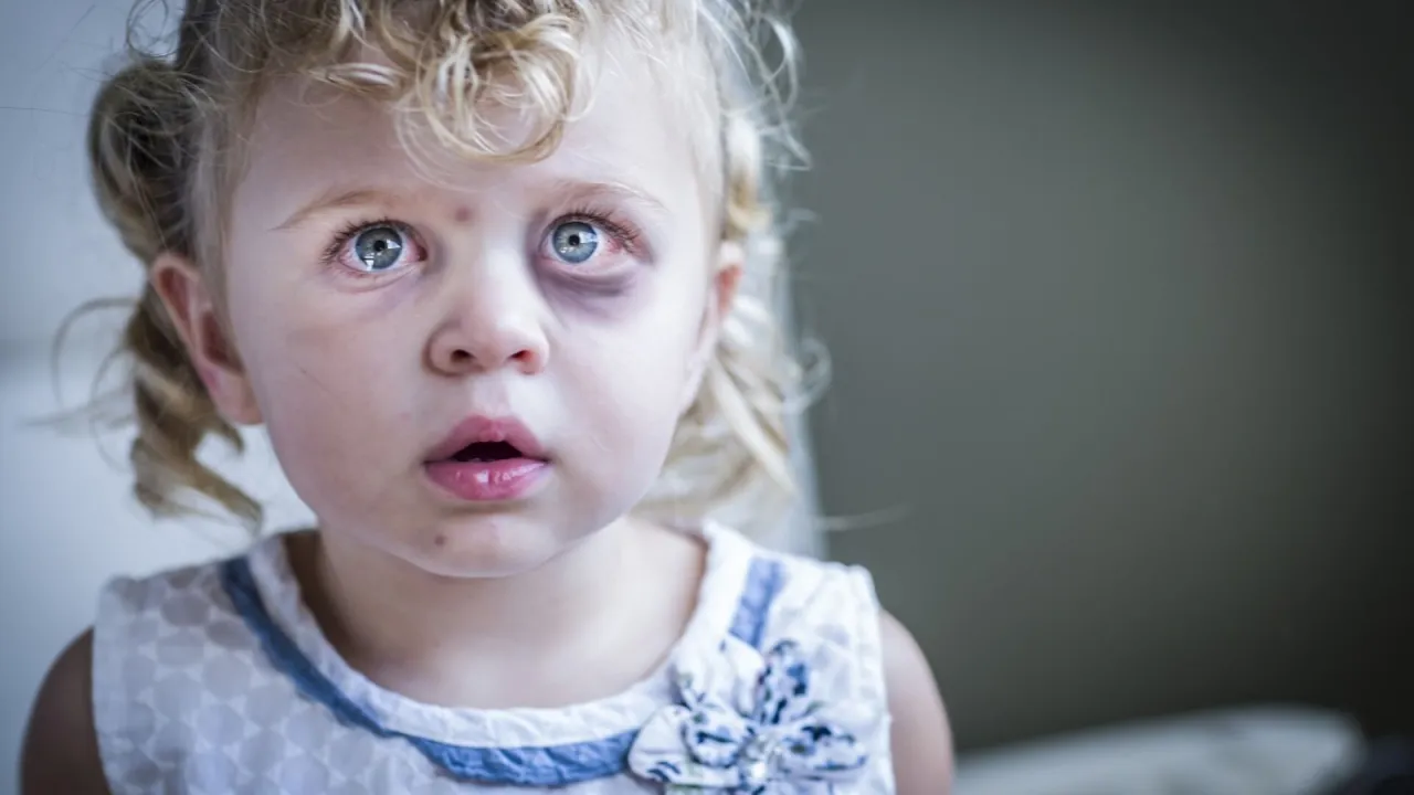 Dziecko maltretowane definicja