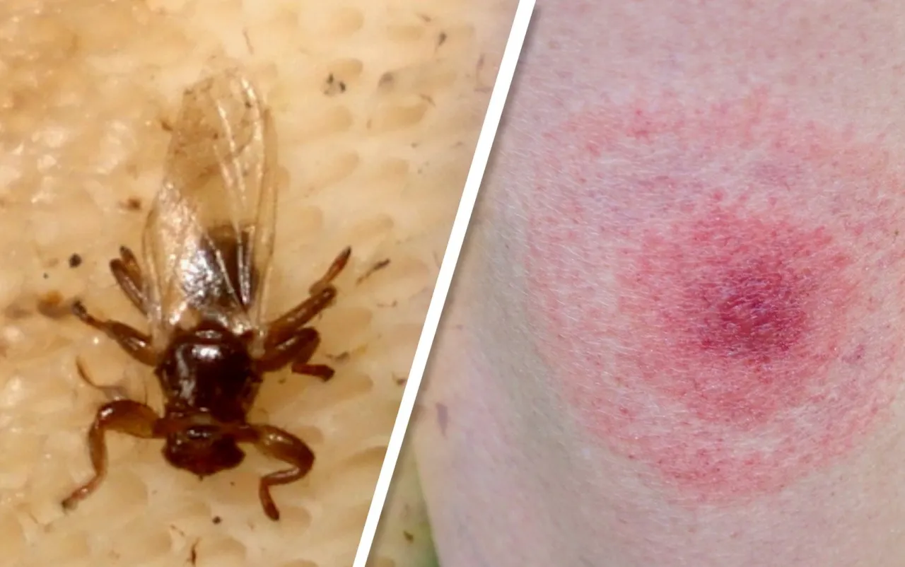 Ukąszenie strzyżaka sarniego zdjęcia