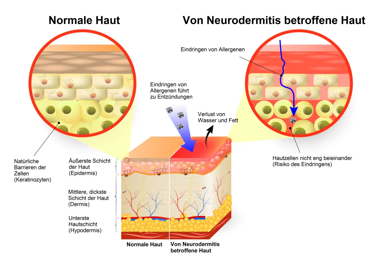 ursachen juckende gesichtshaut infografik