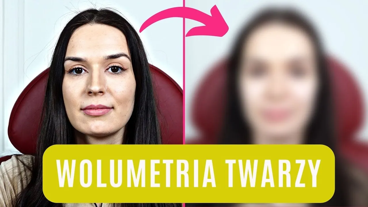 Zdjęcie Radiesse czy kwas hialuronowy - który wypełniacz jest lepszy dla Ciebie?