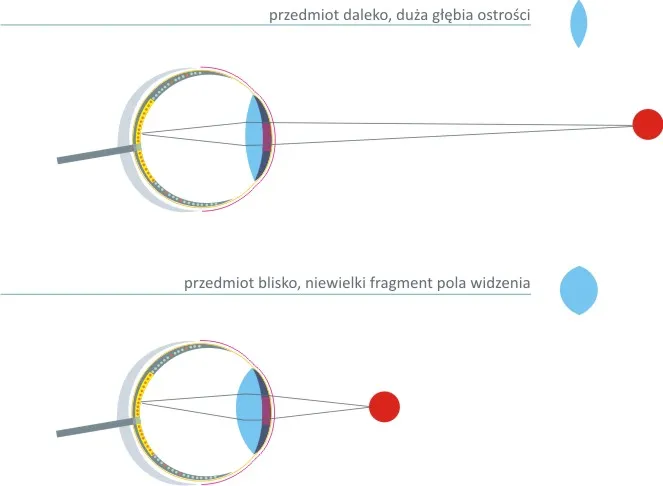 Zdjęcie Jak działa soczewka w oku i jak wpływa na twoje widzenie