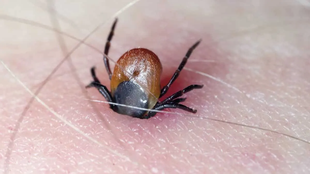 Zdjęcie Cómo matar la garrapata de forma segura y evitar infecciones