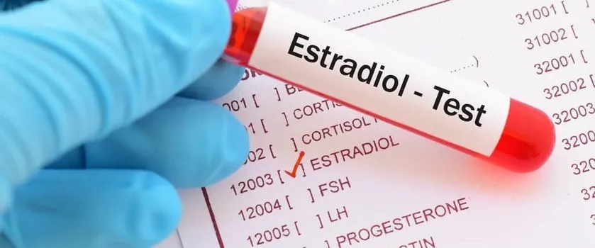 Zdjęcie Kiedy badać estradiol, aby uzyskać wiarygodne wyniki i uniknąć błędów
