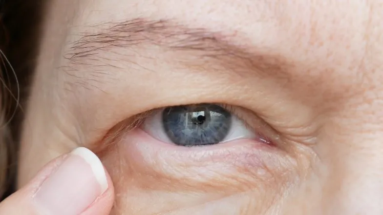 Zdjęcie Opadająca powieka przyczyny neurologiczne: poznaj groźne symptomy
