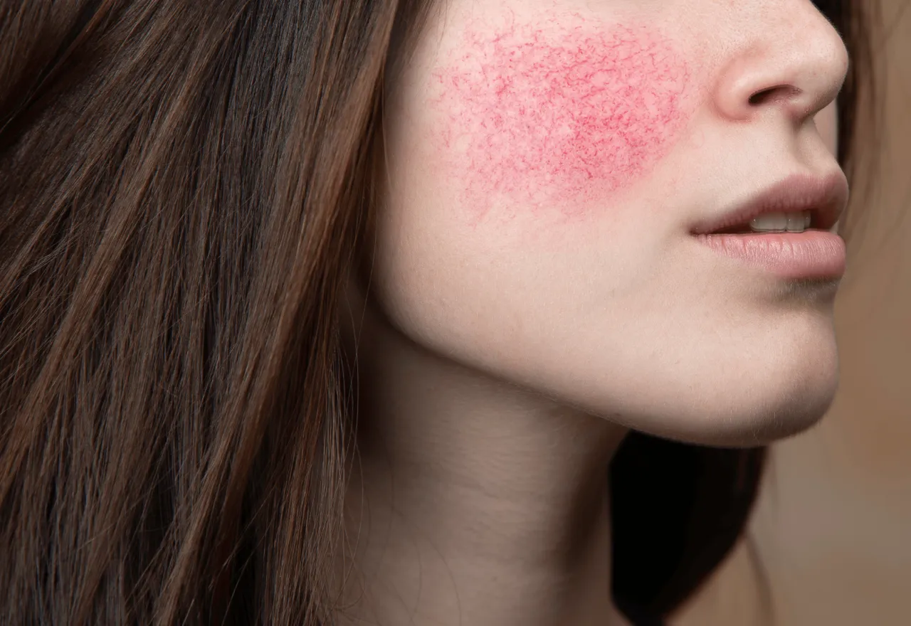 kwas laktobionowy efekty na skórze po miesiącu