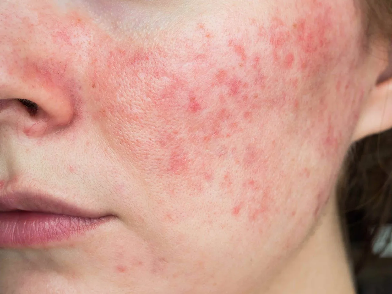 Hautpflegeroutine empfindliche Haut