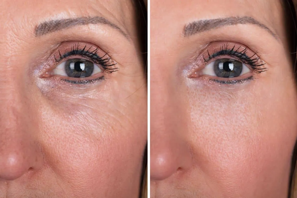 różne rodzaje cieni pod oczami i ich kolory