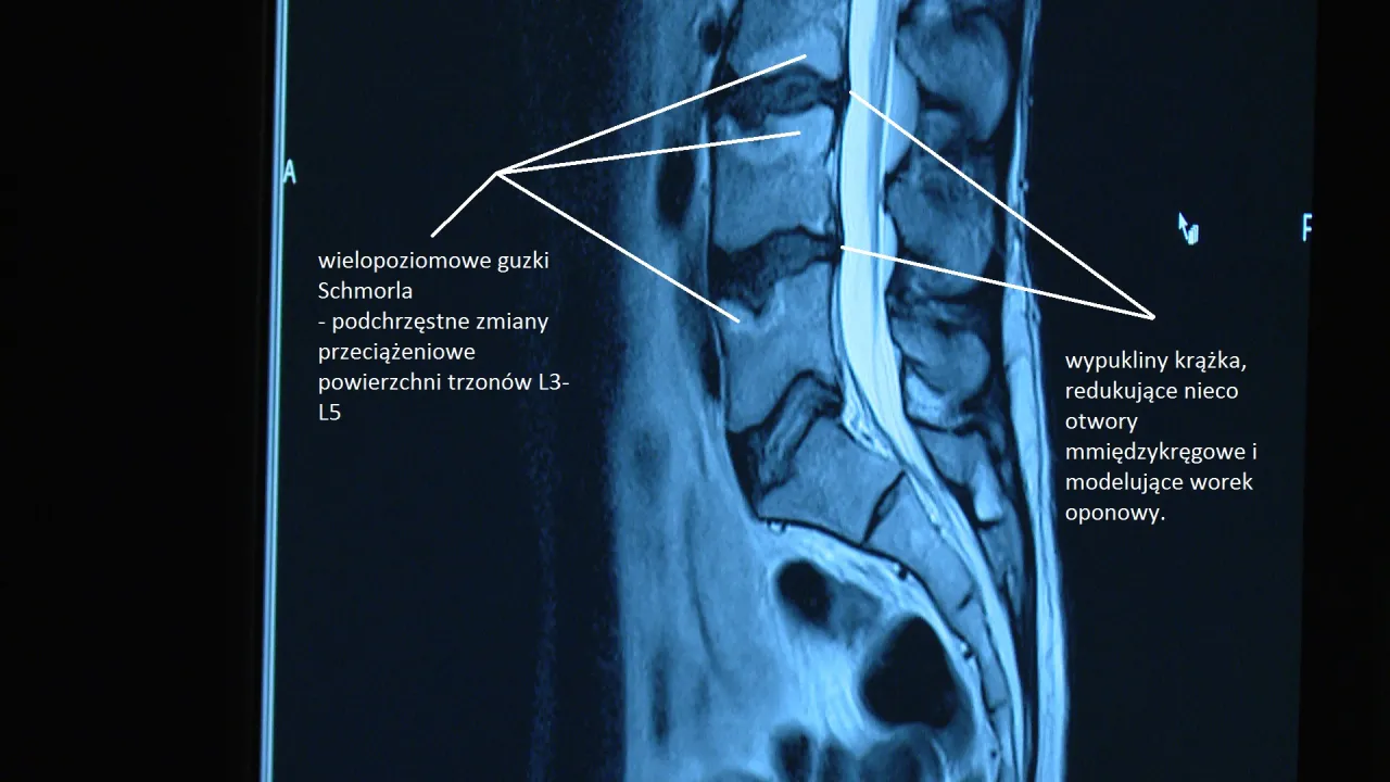 Anatomia kręgosłupa lędźwiowo-krzyżowego