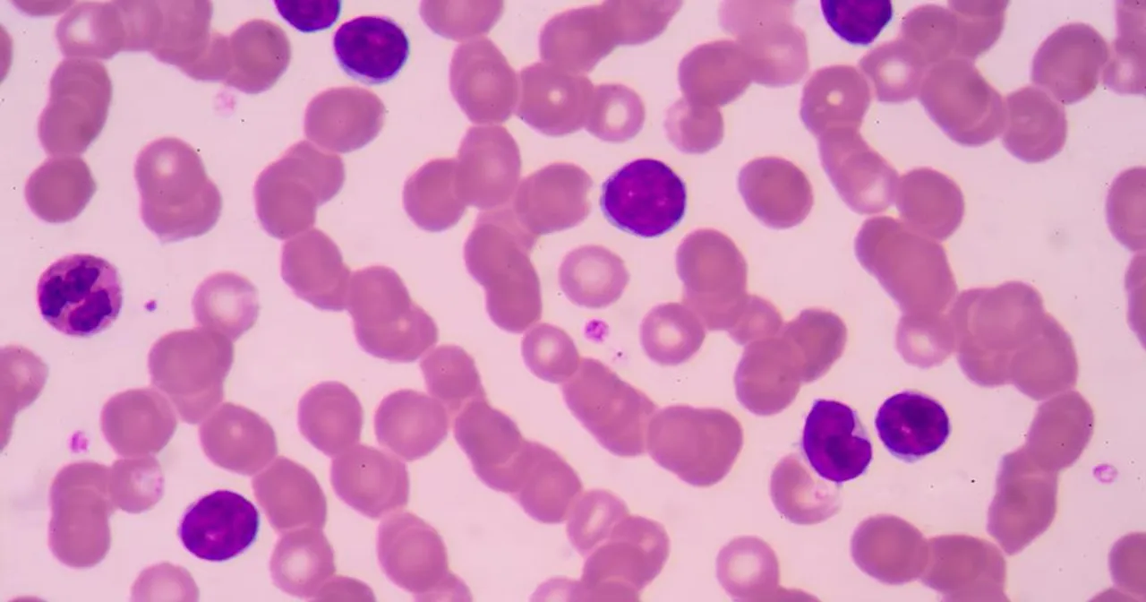 limfocyty pod mikroskopem