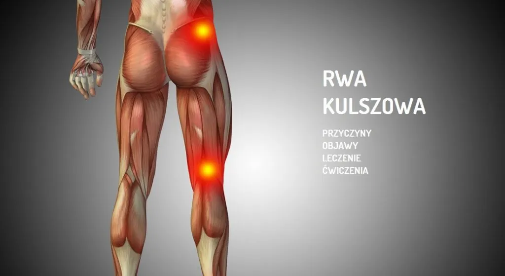 Zdjęcie Kto leczy rwę kulszową? Poznaj specjalistów i skuteczne metody leczenia