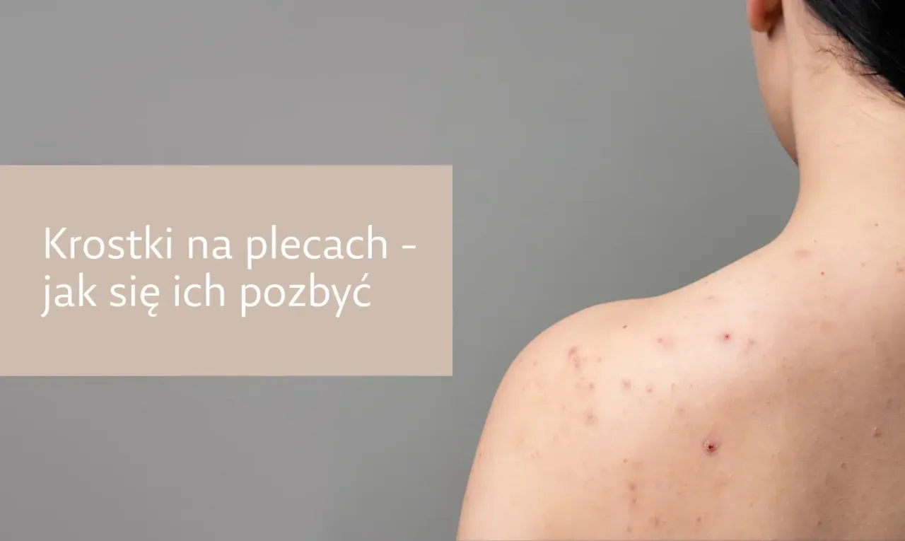kosmetyki na pryszcze na plecach składniki aktywne