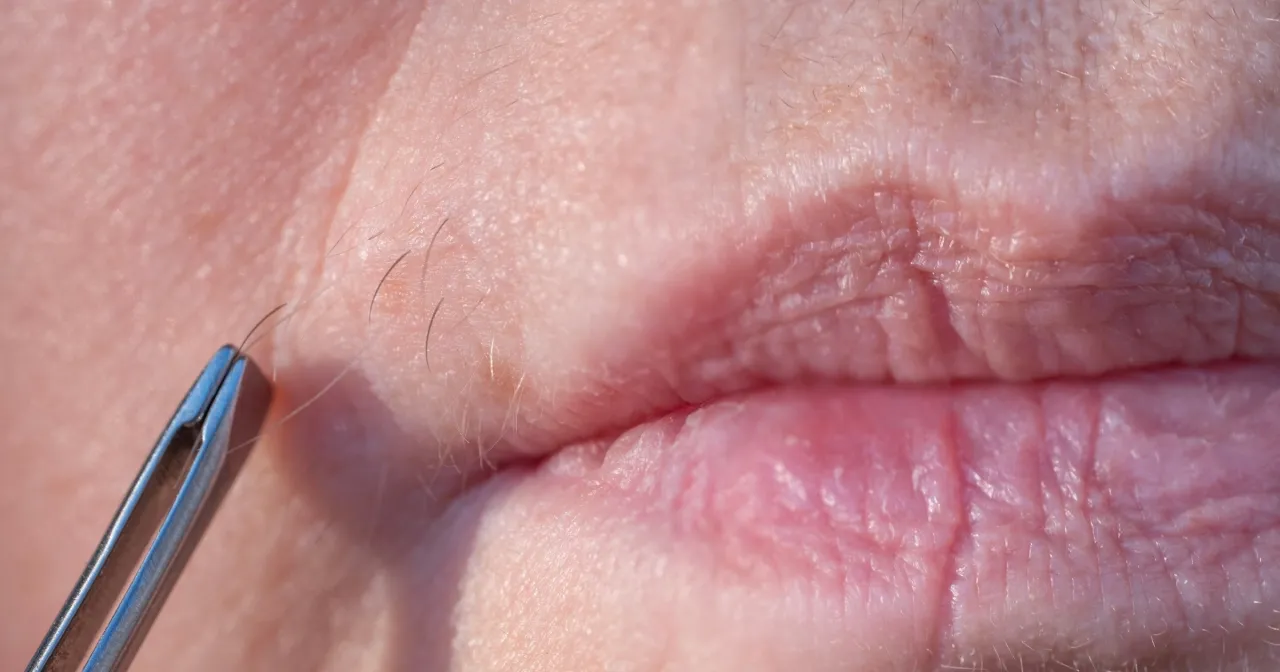 Pielęgnacja sk&oacute;ry po depilacji wąsika